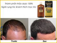 Top 3 loại tinh dầu phục hồi tóc tốt nhất hiện nay